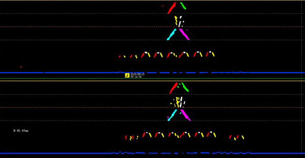 B-Scan interface